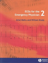 Cover ECGs for the Emergency Physician 2
