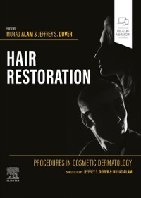 Cover Procedures in Cosmetic Dermatology: Hair Restoration - E-Book