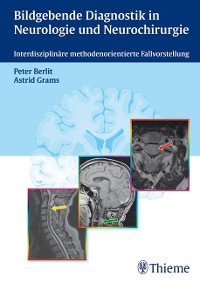 Cover Bildgebende Diagnostik in Neurologie und Neurochirurgie