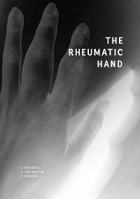 Cover The Rheumatic Hand