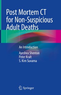 Cover Post Mortem CT for Non-Suspicious Adult Deaths