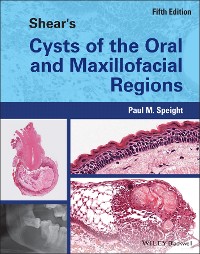 Cover Shear's Cysts of the Oral and Maxillofacial Regions
