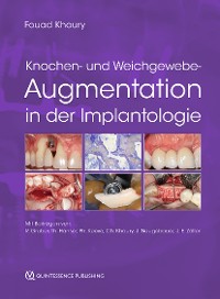 Cover Knochen- und Weichgewebeaugmentation in der Implantologie