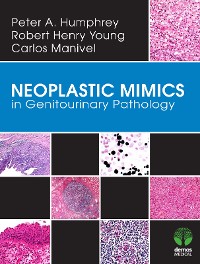 Cover Neoplastic Mimics in Genitourinary Pathology