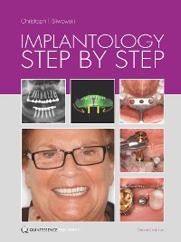 Cover Implantology Step by Step