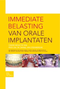 Cover Immediate belasting van orale implantaten