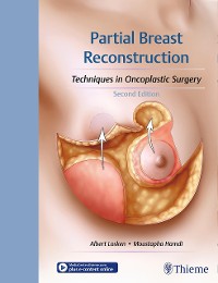 Cover Partial Breast Reconstruction