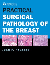 Cover Practical Surgical Pathology of the Breast