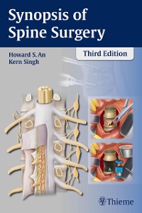 Cover Synopsis of Spine Surgery