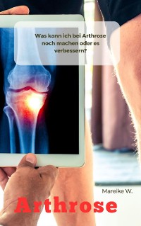 Cover Arthrose