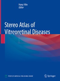 Cover Stereo Atlas of Vitreoretinal Diseases