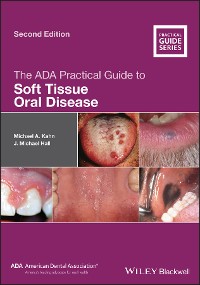 Cover The ADA Practical Guide to Soft Tissue Oral Disease