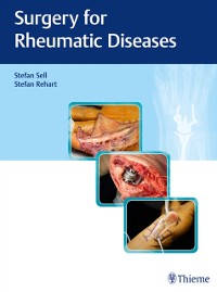 Cover Surgery for Rheumatic Diseases