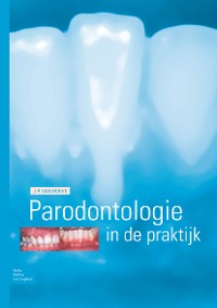 Cover Parodontologie in de praktijk
