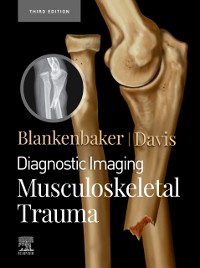 Cover Diagnostic Imaging: Musculoskeletal Trauma,E-Book