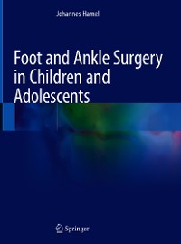 Cover Foot and Ankle Surgery in Children and Adolescents