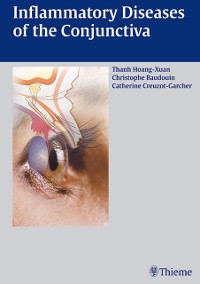 Cover Inflammatory Diseases of the Conjuctiva