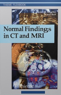 Cover Normal Findings in CT and MRI