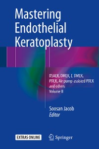 Cover Mastering Endothelial Keratoplasty