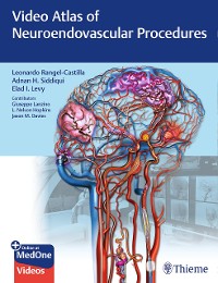Cover Video Atlas of Neuroendovascular Procedures