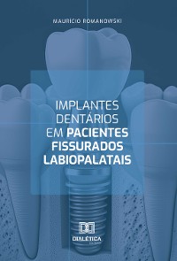 Cover Implantes dentários em pacientes fissurados labiopalatais