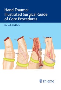Cover Hand Trauma: Illustrated Surgical Guide of Core Procedures