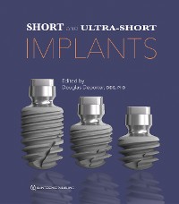 Cover Short and Ultra-Short Implants