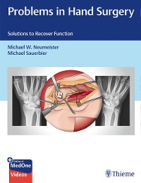 Cover Problems in Hand Surgery