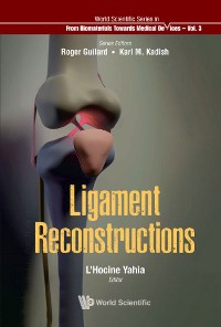 Cover Ligament Reconstructions