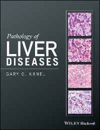 Cover Pathology of Liver Diseases