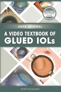 Cover Video Textbook of Glued IOLs