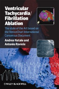 Cover Ventricular Tachycardia / Fibrillation Ablation