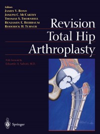 Cover Revision Total Hip Arthroplasty