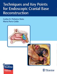 Cover Techniques and Key Points for Endoscopic Cranial Base Reconstruction