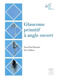 Cover Glaucome primitif à angle ouvert
