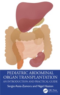 Cover Pediatric Abdominal Organ Transplantation : An Introduction and Practical guide