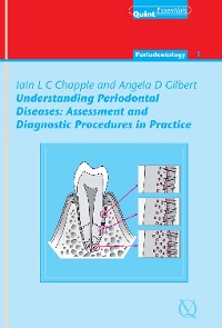 Cover Understanding Periodontal Diseases: Assessment and Diagnostic Procedures in Practice