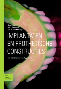 Cover Implantaten en prothetische constructies