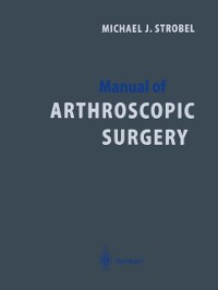 Cover Manual of Arthroscopic Surgery