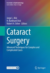Cover Cataract Surgery