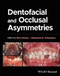 Cover Dentofacial and Occlusal Asymmetries