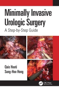Cover Minimally Invasive Urologic Surgery