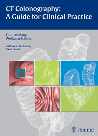 Cover CT Colonography: A Guide for Clinical Practice