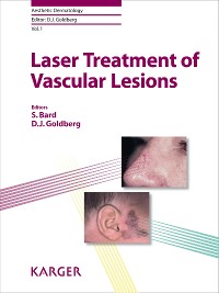 Cover Laser Treatment of Vascular Lesions