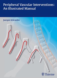 Cover Peripheral Vascular Interventions: An Illustrated Manual