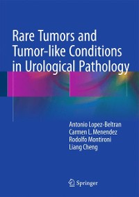 Cover Rare Tumors and Tumor-like Conditions in Urological Pathology