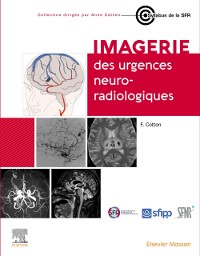 Cover Imagerie des urgences neuroradiologiques