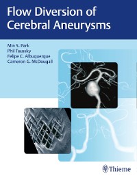 Cover Flow Diversion of Cerebral Aneurysms