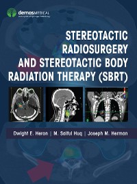 Cover Stereotactic Radiosurgery and Stereotactic Body Radiation Therapy (SBRT)