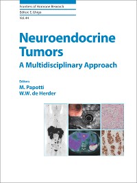 Cover Neuroendocrine Tumors: A Multidisciplinary Approach